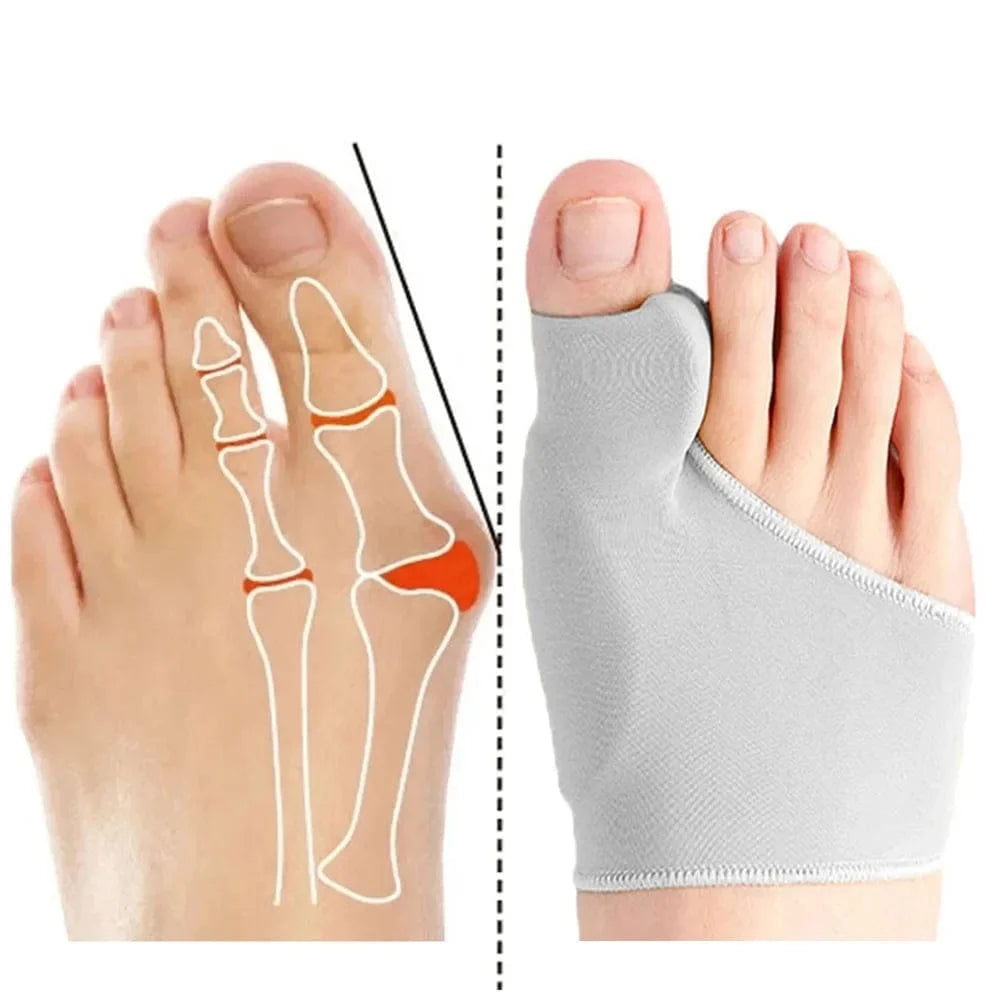 Chaussette Orthopédique Femme pour le Traitement d’Hallux Valgus
