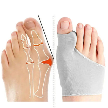 Chaussette Orthopédique Femme pour le Traitement d’Hallux Valgus