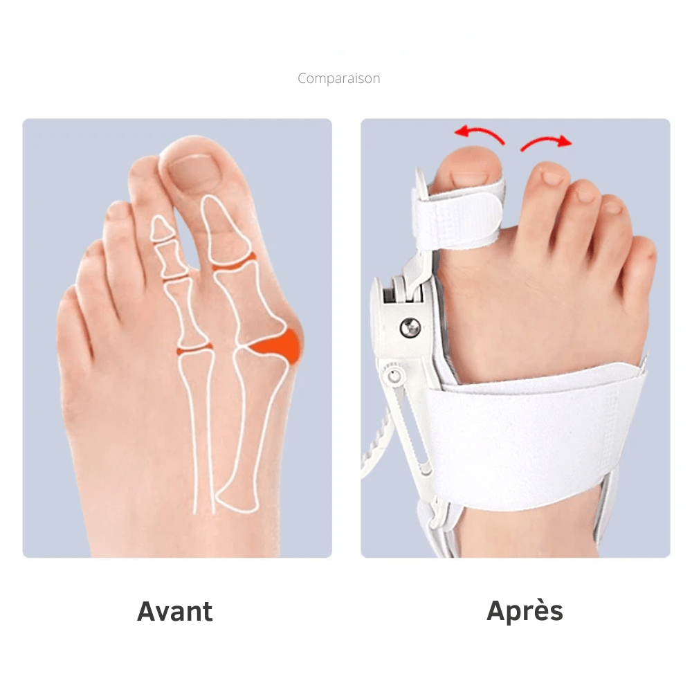 Chaussette Orthopédique Homme Ajusteur Pouce de Pied