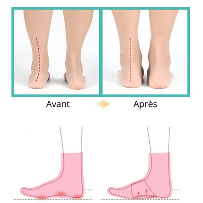 Lot De 4 Pièces Orthopédiques En Silicone Pour Pieds Plats